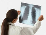 Как лечить туберкулёз?